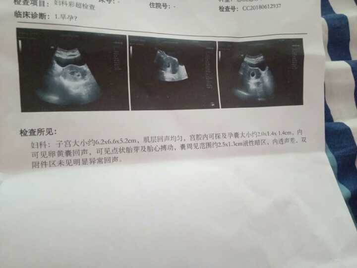 代怀孕流程表_供卵代怀_孕期血糖高吃什么水果最好降糖最快?