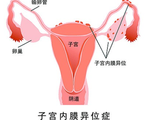 南昌妇产医院试管婴儿成功率,南昌大学第三医院供卵生男孩实际成功率均已达