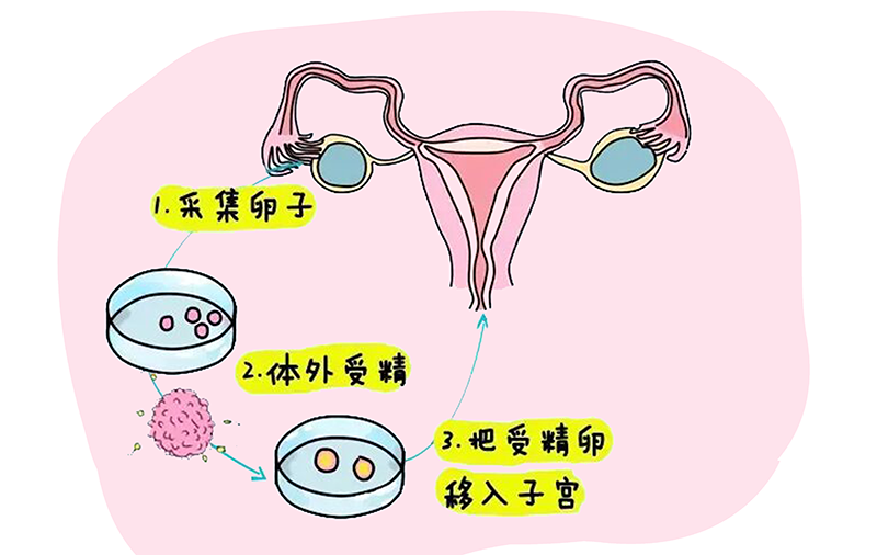 代怀包生男孩_代怀包成功多少钱_在鄂尔多斯的私立妇产医院做试管婴儿费用多